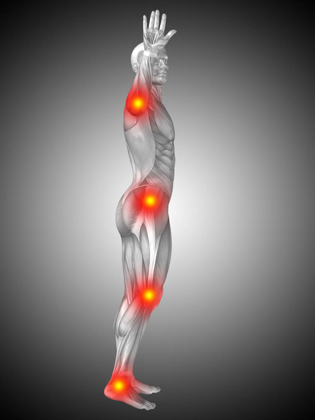 Ilustración conceptual 3D del cuerpo de la anatomía humana con dolor e inflamación, fondo de gradiente gris
 - Foto, Imagen