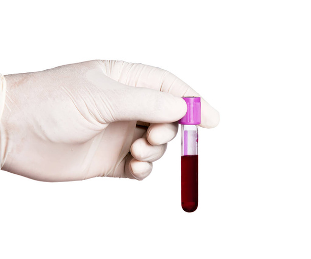 hand holding collection blood specimen isolated on white background - Fotografie, Obrázek