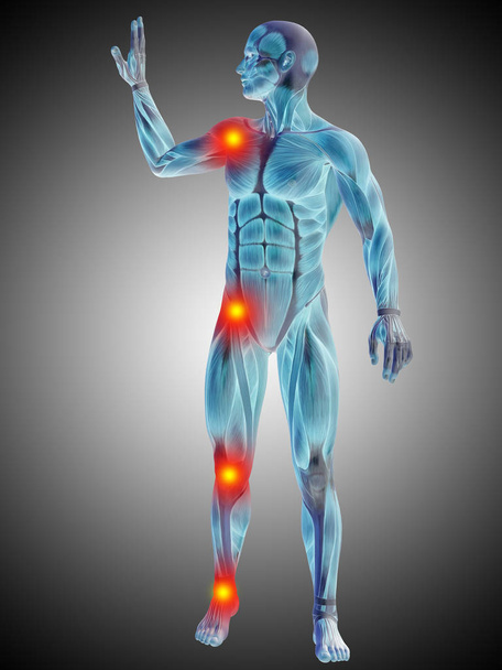 Conceptuele 3d illustratie van de menselijke anatomie lichaam met pijn en ontsteking, grijze achtergrond met kleurovergang - Foto, afbeelding