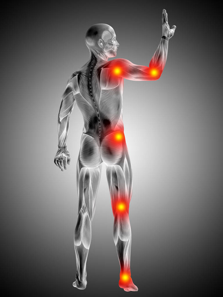 Εννοιολογική απεικόνιση 3d ανθρώπινη ανατομία σώμα με το πόνο και την φλεγμονή, την γκρι φόντο κλίση - Φωτογραφία, εικόνα