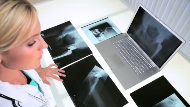 Női orvos megtekintés röntgen vizsgál - Felvétel, videó