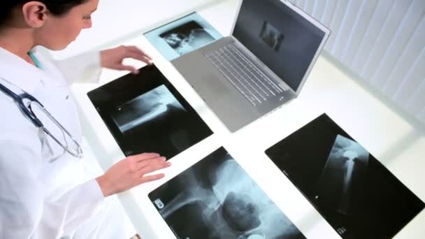 Médico feminino visualizando varreduras de raios X
 - Filmagem, Vídeo