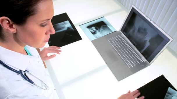 Lääkäri radiologiassa tutkimassa röntgenkuvia
 - Materiaali, video
