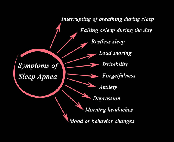 Deset příznaky spánkové apnoe - Fotografie, Obrázek