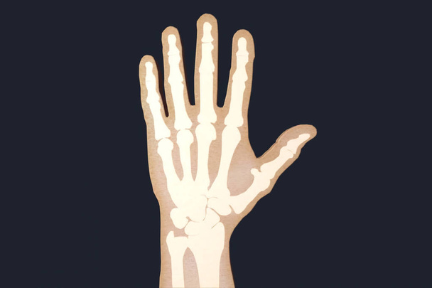 Mano humana radiografiada. Radiografía de los huesos de las manos
 - Foto, Imagen