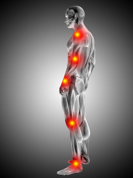 İnsan anatomisi vücut ağrı ve enflamasyon, gradyan arka planı gri ile kavramsal 3d çizimi - Fotoğraf, Görsel