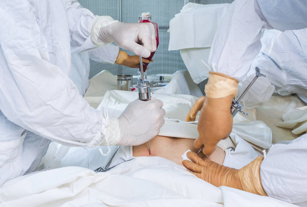 operacji przeszczepu szpiku kostnego - Zdjęcie, obraz