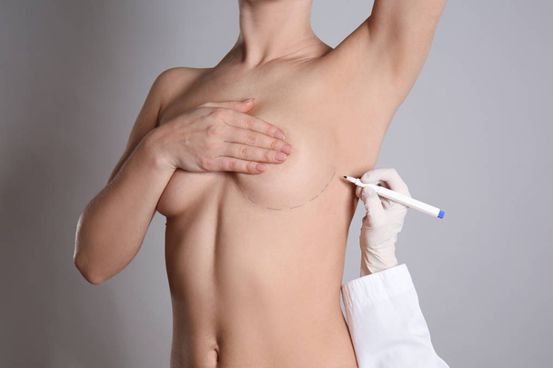 Marcas de dibujo médico en la mama femenina antes de la operación de cirugía estética contra el fondo gris
 - Foto, Imagen