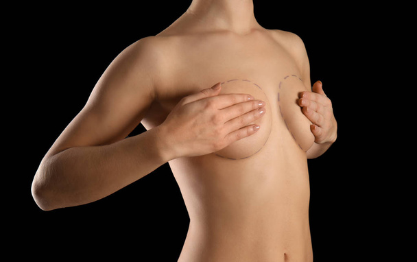 Νεαρή γυναίκα με σημάδια στο στήθος για την αισθητική χειρουργική λειτουργία σκούρο φόντο - Φωτογραφία, εικόνα