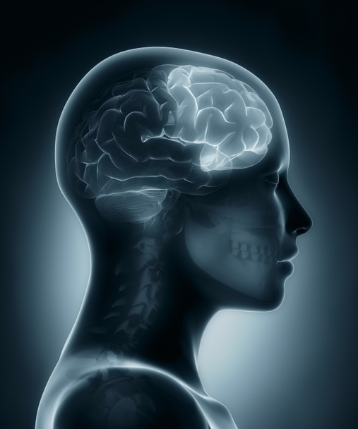 Lobe frontal radiographie médicale
 - Photo, image
