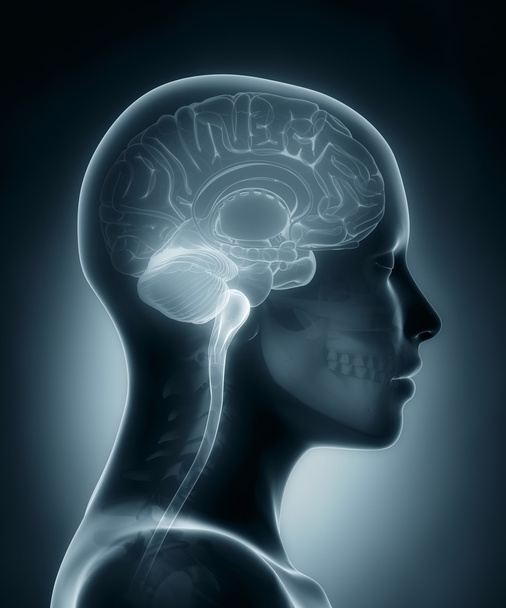 mózg kobiety medyczny x-ray skanowania - Zdjęcie, obraz