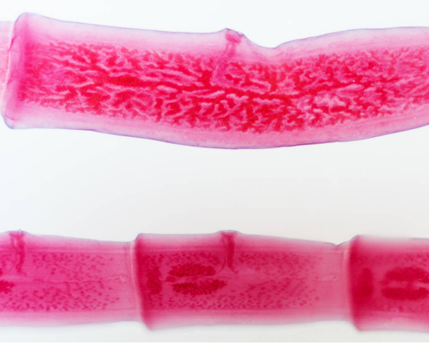 Vaste gebeitst slides van lintworm secties - Foto, afbeelding