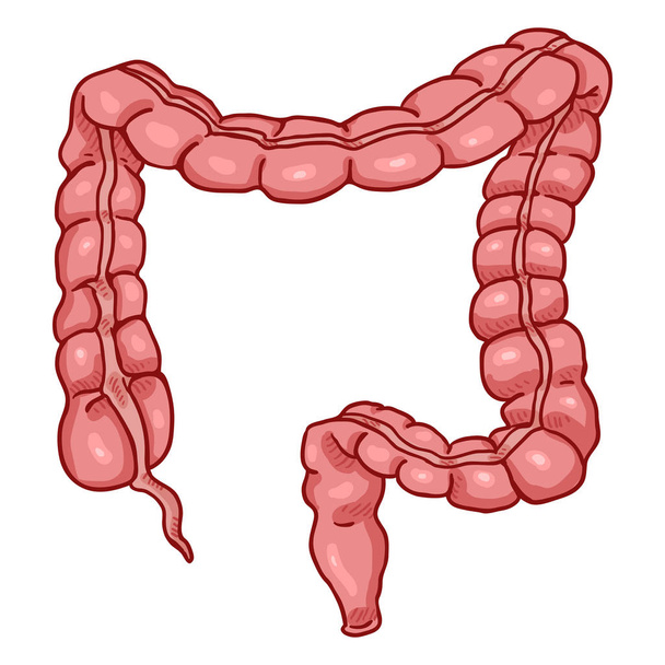 Vector Cartoon Human Large Intestine . Anatomical Organ Illustration. - Vektor, Bild
