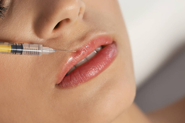 Mujer joven recibiendo la inyección de labios, primer plano. Cirugía estética
 - Foto, imagen