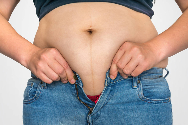 Corps de femme en surpoids avec graisse sur le ventre - concept d'embonpoint et d'obésité
 - Photo, image