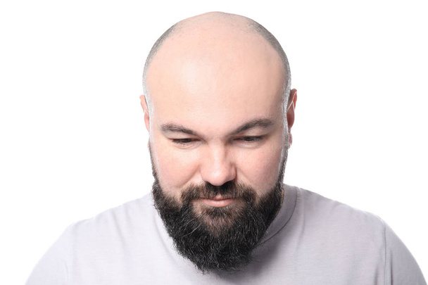 Homme avec problème de perte de cheveux sur fond blanc
 - Photo, image