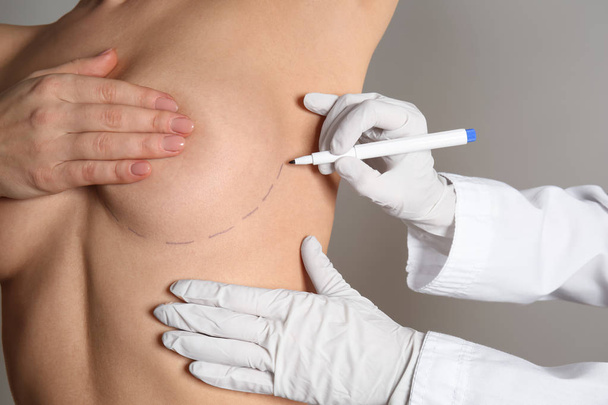 Doctor drawing marks on female breast before cosmetic surgery operation against grey background - Photo, Image