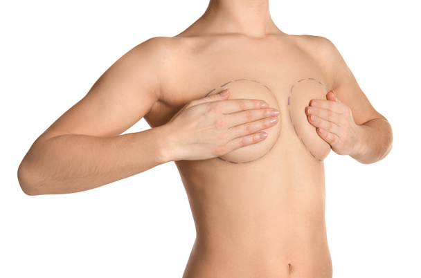 白い背景に、美容外科手術の胸のマークを持つ若い女性 - 写真・画像