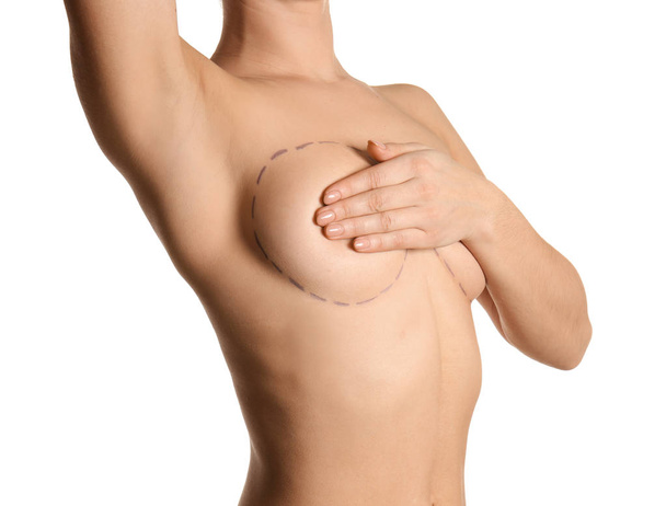Mladá žena se značkami na prsa pro kosmetické chirurgie operace proti bílým pozadím - Fotografie, Obrázek