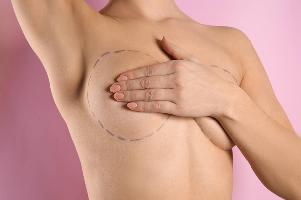 Молодая женщина с отметинами на груди для косметической операции на цветном фоне
 - Фото, изображение