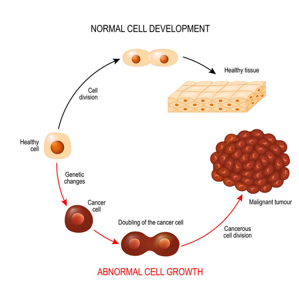Cancer cell and normal cell. Healthy tissue and Malignant tumour. illustration showing cancer disease development. Vector diagram for your design, educational, biological, science and medical use - Vector, Image