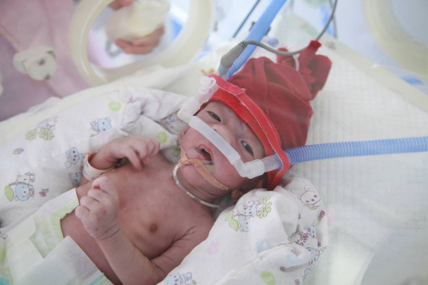 A newborn baby, who has been kept her eyes opening for 13 days after she was born, is being treated in an incubator at the Hubei Maternal and Child Health Hospital in Wuhan city, central China's Hubei province, 9 April 2018 - Фото, изображение