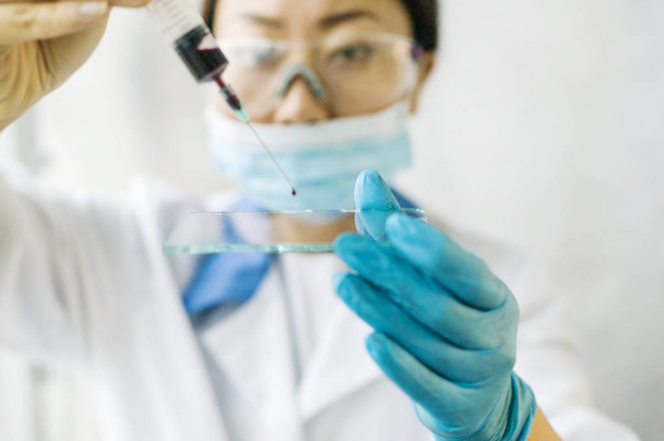 Assistente di laboratorio in camice bianco e guanti fa un esame del sangue in laboratorio. Ricerca scientifica in chimica
. - Foto, immagini