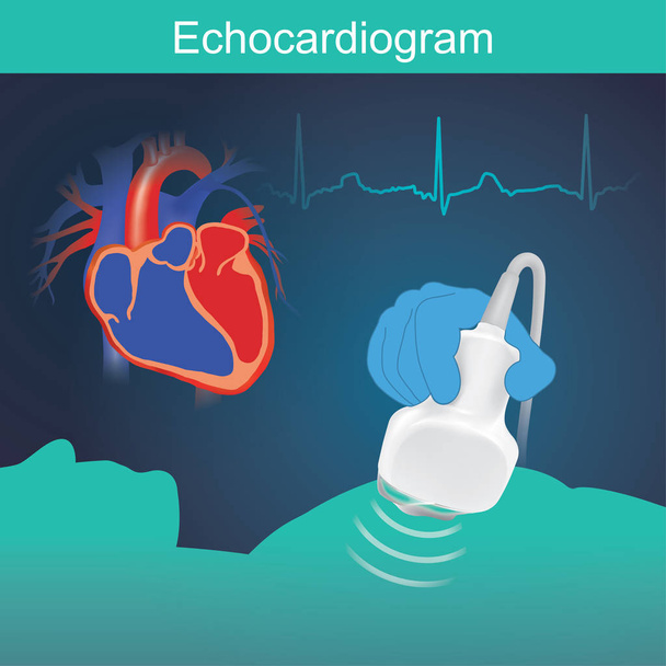 Kalp muayenesi ile yüksek frekanslı ses dalgaları çok yararlı diğer belirtiler de dahil olmak üzere kalp fonksiyonu değerlendirilmesinde. - Vektör, Görsel