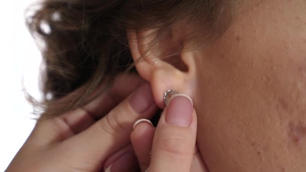 Mujer con la cara de acné cicatrizado pone un pendiente en su oído
 - Metraje, vídeo