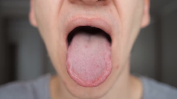 Hombre que toma la píldora, tableta de medicamentos o medicamentos en la lengua con la boca abierta
 - Metraje, vídeo