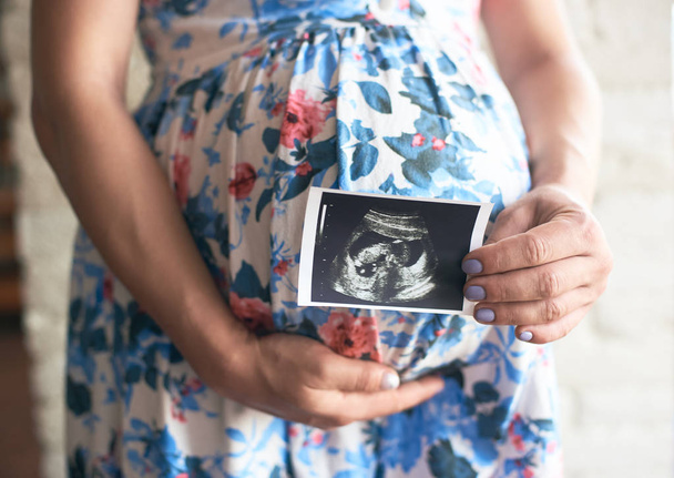 Femme enceinte en robe fleurie montrant l'image échographique du bébé
 - Photo, image