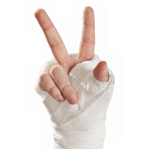 gebrochener Arm im Gips. Finger zeigen Charakter Hippies - Frieden - Foto, Bild