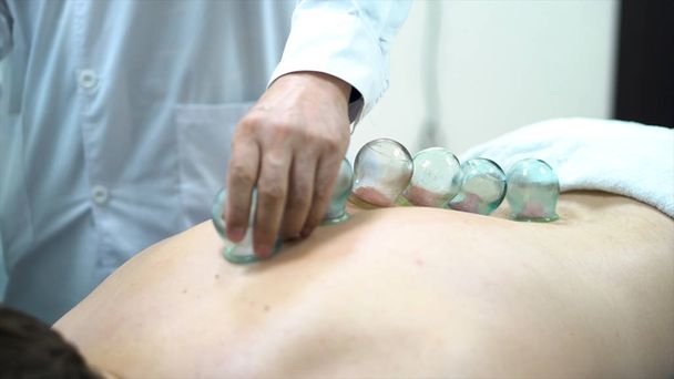Akupunktúra terapeuta forgalomba egy csésze a hát egy férfi beteg, ősi kínai gyógyászat. Közelről, az orvos ad köpölyöző fiatalember vissza. - Fotó, kép