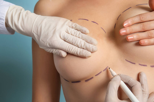 Doctor drawing marks on female breast before cosmetic surgery operation against color background - Photo, Image