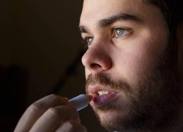 Young man with a beard repairing his damaged lips with moisturizer - Foto, Imagem