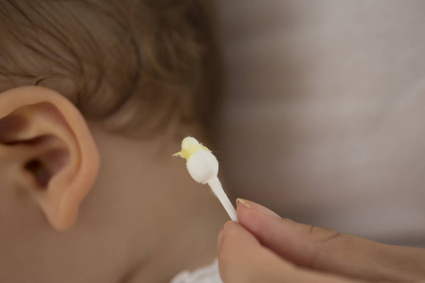 ušní maz na ucho swab.baby bavlny - Fotografie, Obrázek