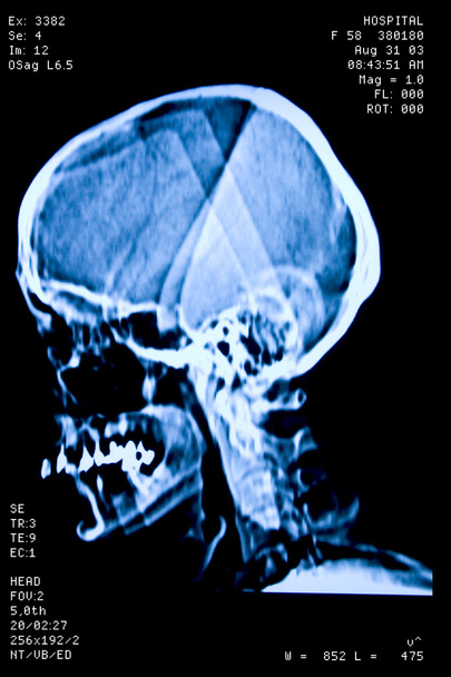 czaszka rezonansu - Zdjęcie, obraz