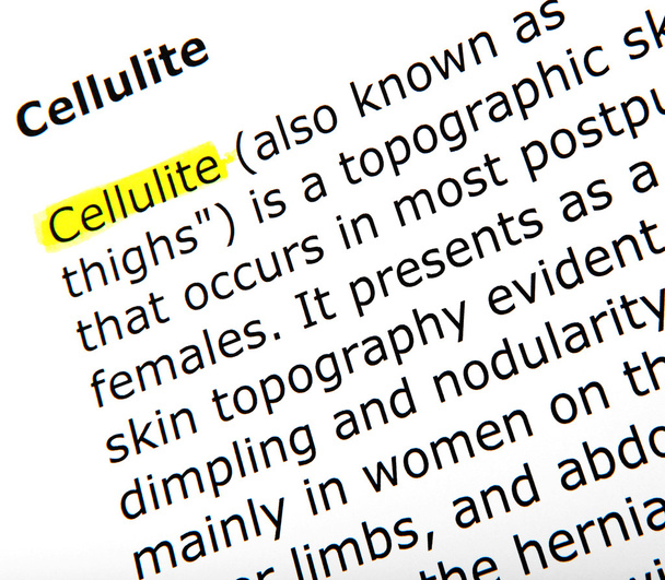 Cellulite - Photo, image