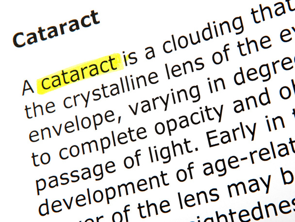 Cataracte
 - Photo, image