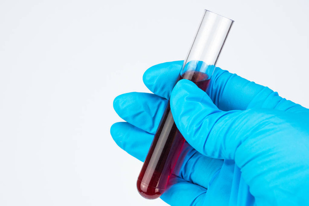 Hand doctor closeup. A lab technician in a blue rubber glove holds a glass test tube full of blood. Analyzes in the doctor's hand on the right of the photo. White background, place for signature, copyspace - Fotoğraf, Görsel