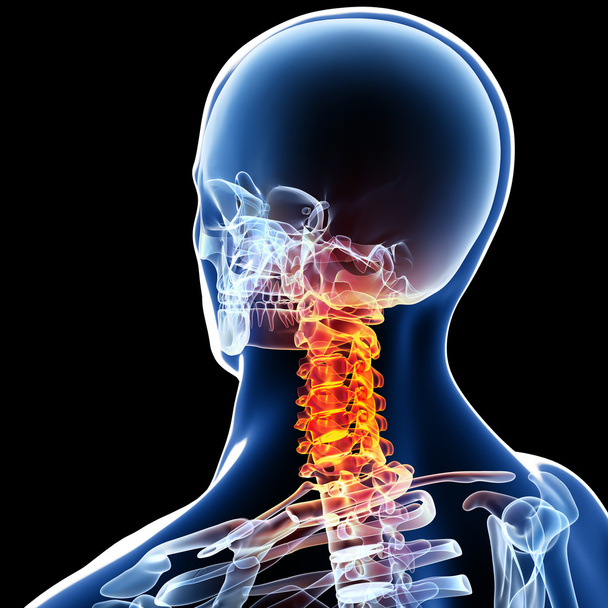 raio-X de dor no pescoço
 - Foto, Imagem