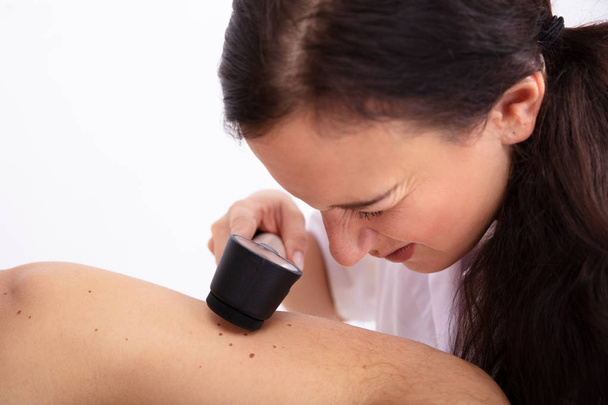 Vrouwelijke arts onderzoekt de huid van mannelijke patiënt met dermatoscoop in de kliniek - Foto, afbeelding