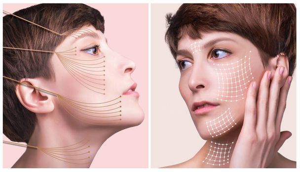 концепція пластичної хірургії шкіри. Жінка обличчям зі слідами і стрілками
 - Фото, зображення