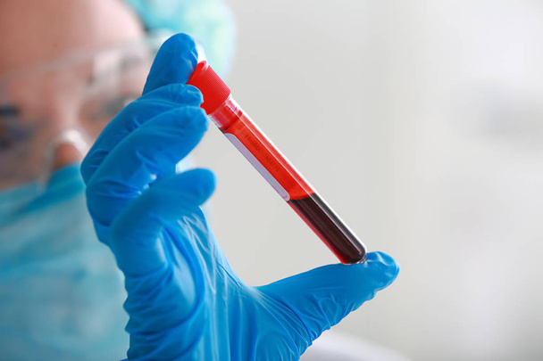 Woman working with blood sample in laboratory, closeup - Photo, Image
