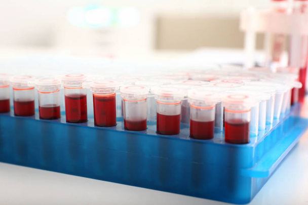 Tubos de ensaio com amostras de sangue na mesa em laboratório
 - Foto, Imagem