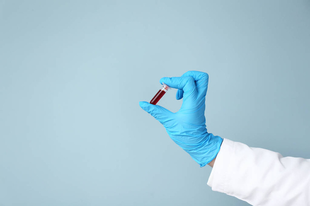 Χέρι του εργαστηρίου Βοηθός εκμετάλλευση δοκιμαστικό σωλήνα με δείγμα αίματος στο χρώμα φόντου - Φωτογραφία, εικόνα