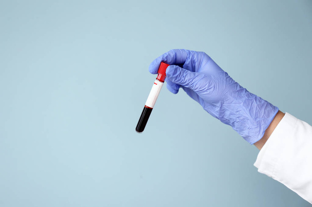 Hand of laboratory assistant holding test tube with blood sample on color background - Photo, image