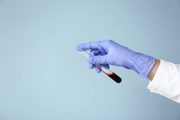 Рука лаборанта держит пробирку с образцом крови на цветном фоне
 - Фото, изображение