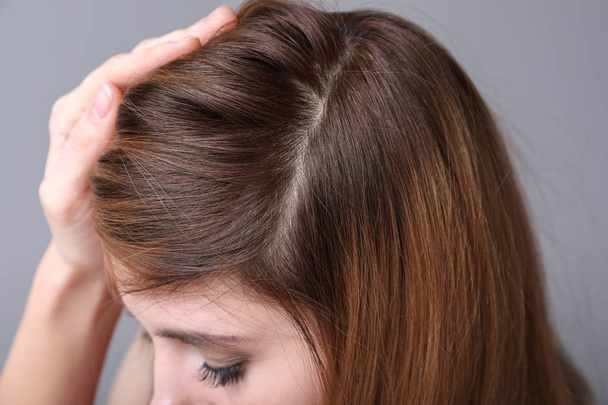 Femme avec problème de perte de cheveux sur fond gris, gros plan
 - Photo, image