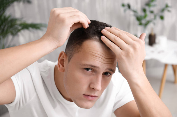 Man with hair loss problem at home - Foto, Imagen